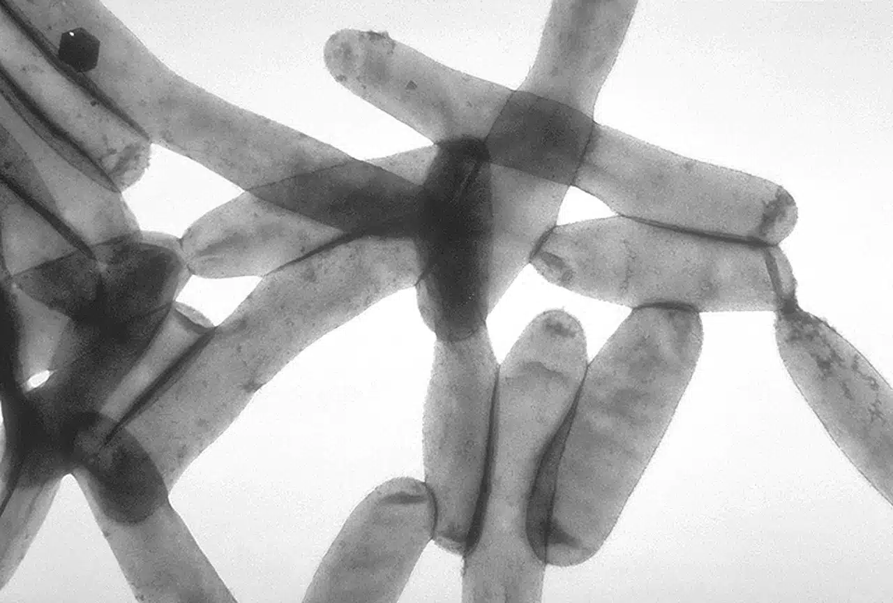 Ilustración de Legionella al microscopio